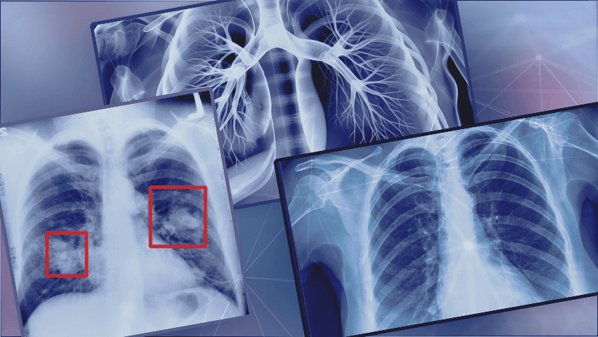 AI tool enhances transparency in X-ray...